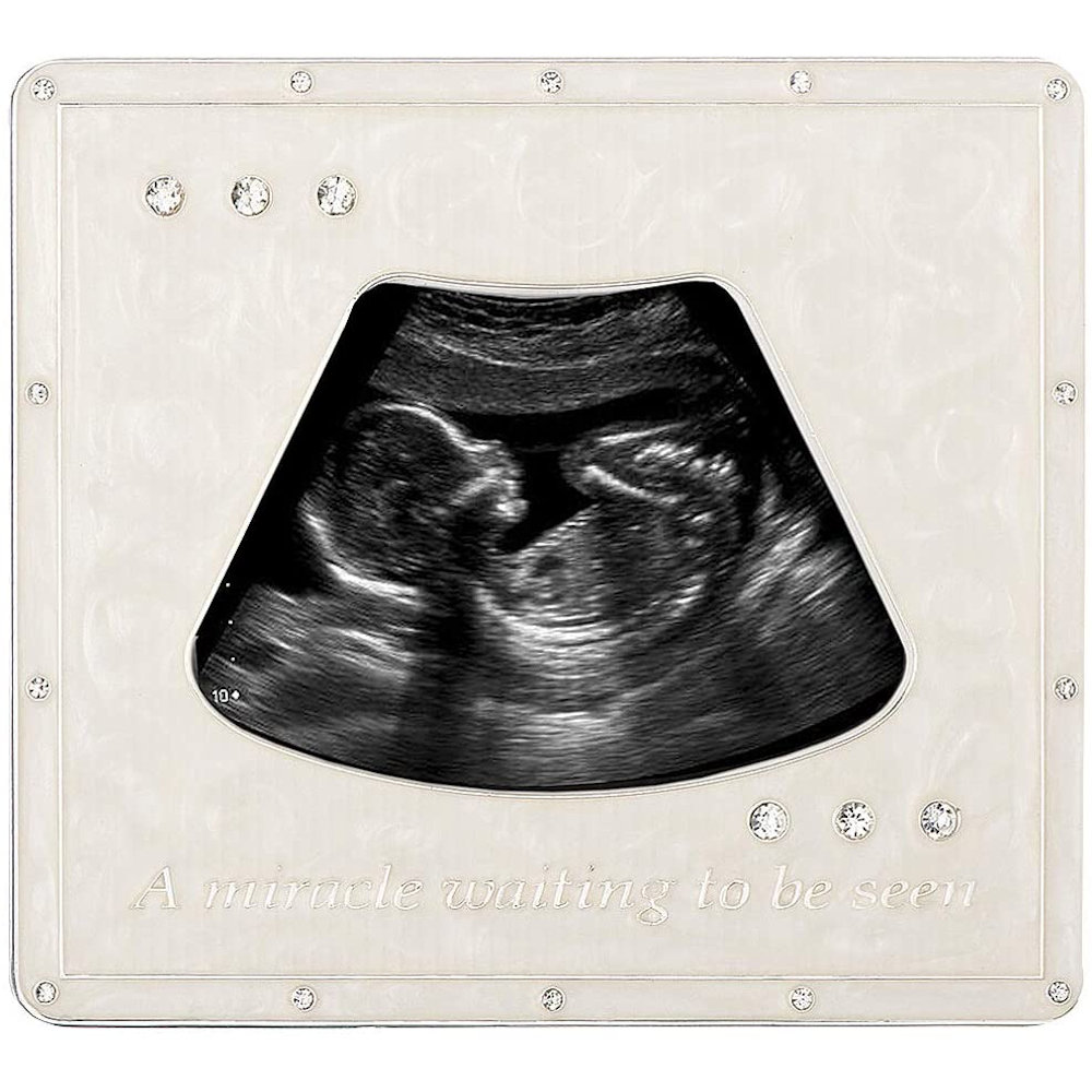 Roman Miracle Waiting to be Seen Ultrasound Frame